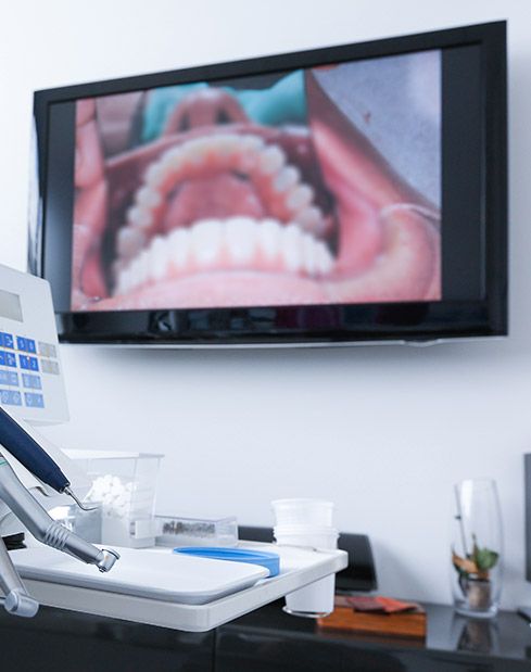 Intraoral images on computer screen
