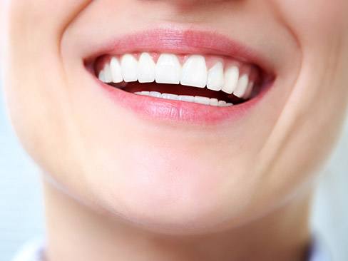 Closeup of flawless smile after dental bonding