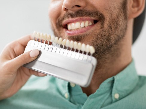 Dentist color matching veneers to male patient’s natural teeth