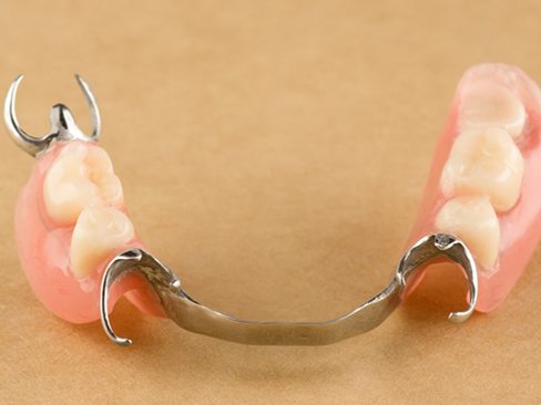 A partial denture