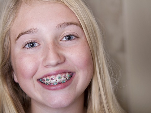 Teenage girls wearing braces in Garland