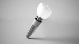 Image of a dental implant against a grey background